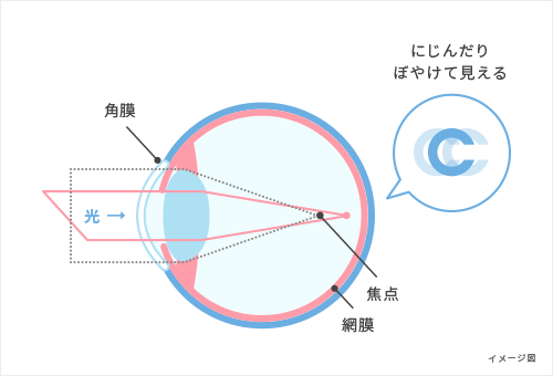 乱視のしくみ図解