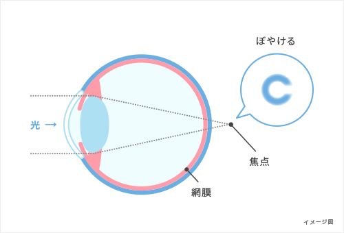 遠視のしくみ図解