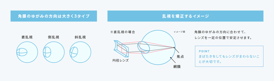 角膜のゆがみの方向は大きく3タイプ　乱視を矯正するイメージ