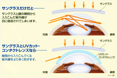 サングラスだけと、サングラスとUVカット・コンタクトレンズの組み合わせの効果比較