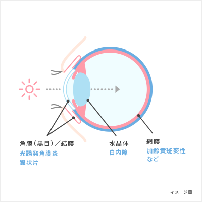 紫外線が目に与える影響